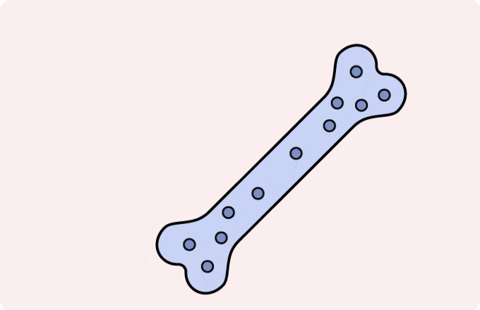 what is osteoporosis