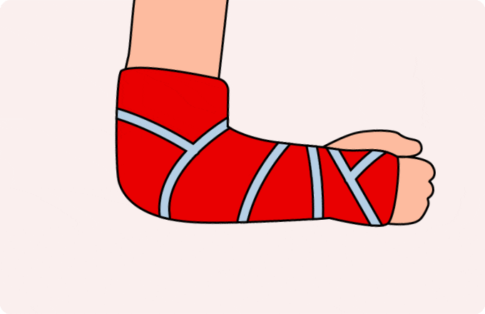 osteoporosis and fall risks