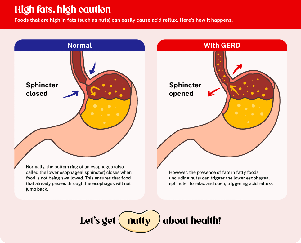 Alternative for nuts, healthy snacking, GERD