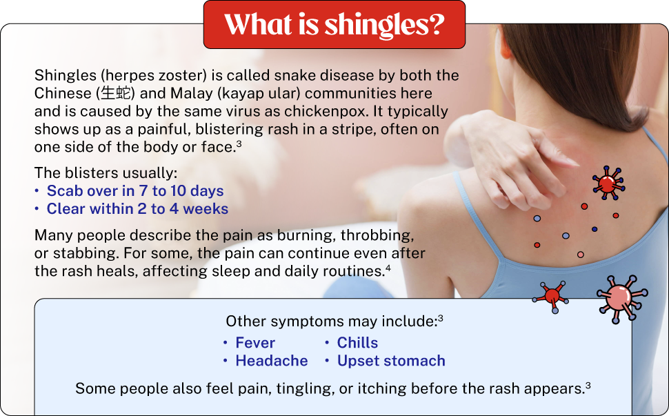 what is shingles herpes zoster snake disease kayap ular symptoms 
