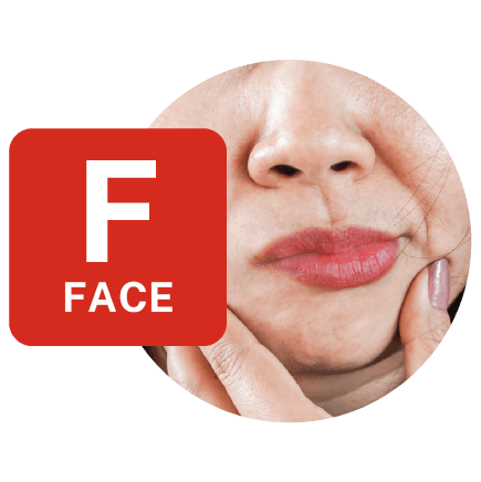 how to spot stroke using FAST method